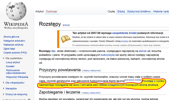 usuwanie rozstępów - wikipedia o rozstępach